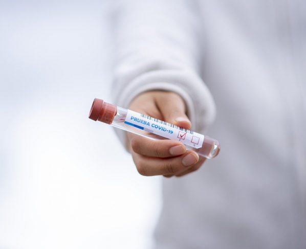 Korona virus Zlatiborski okrug